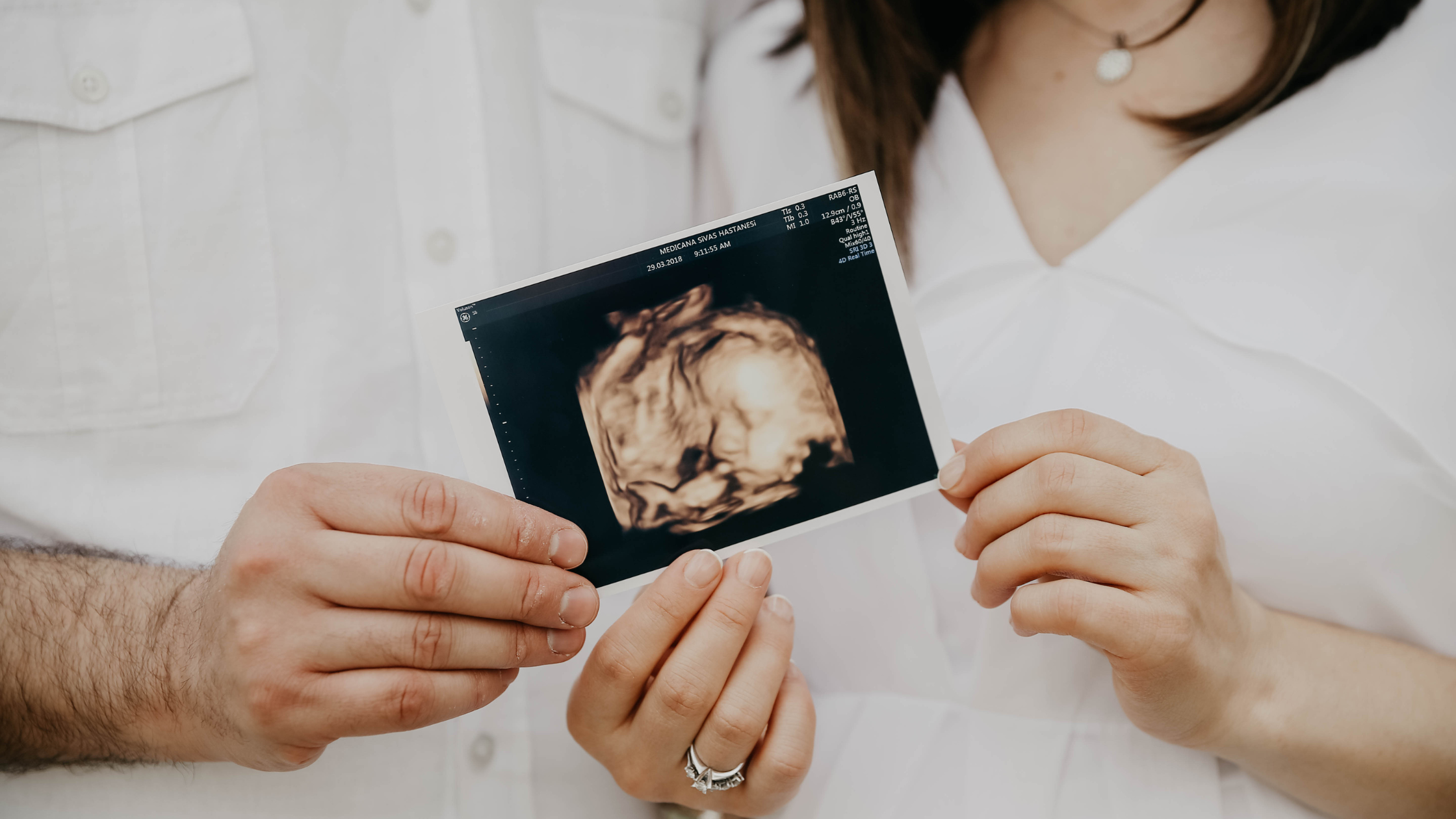 Message pour annoncer une grossesse : 6 idées originales et drôles qui font mouche